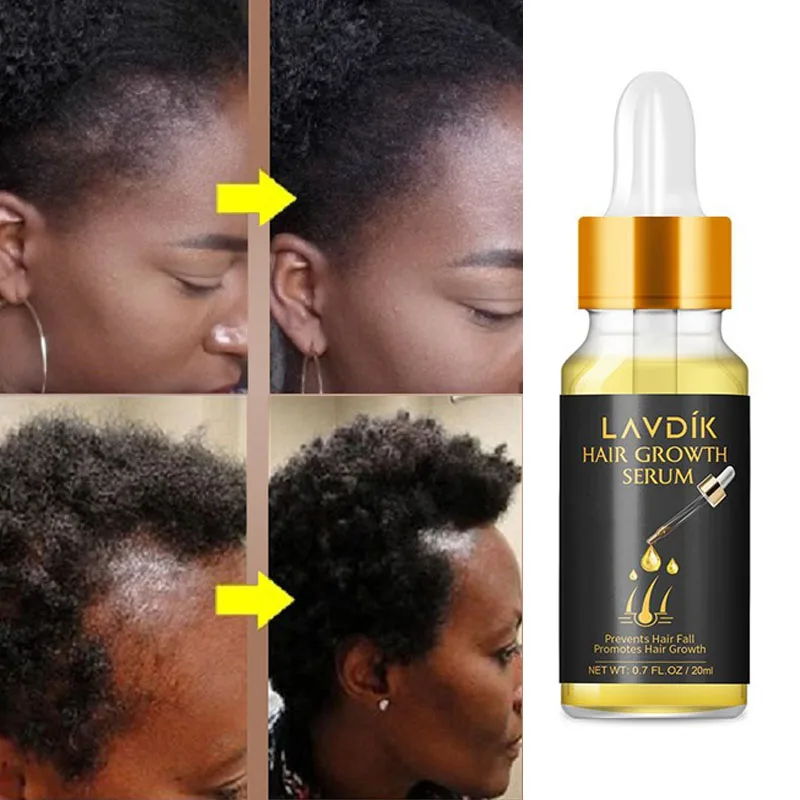 

Hair Fast Growth Essential Oil Treatment Loss Repairing Damaged Hair Serum Nourishing Scalp Anti-dry Bifurcation Care Products