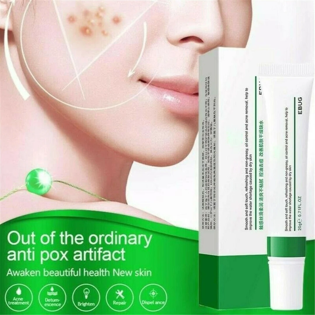 

1 Set 20g Herbal Acne Removal Cream Oil Control Moisturizing Acne Shrink Pores Spots Cream Treatment Facial Skin Care Beauty