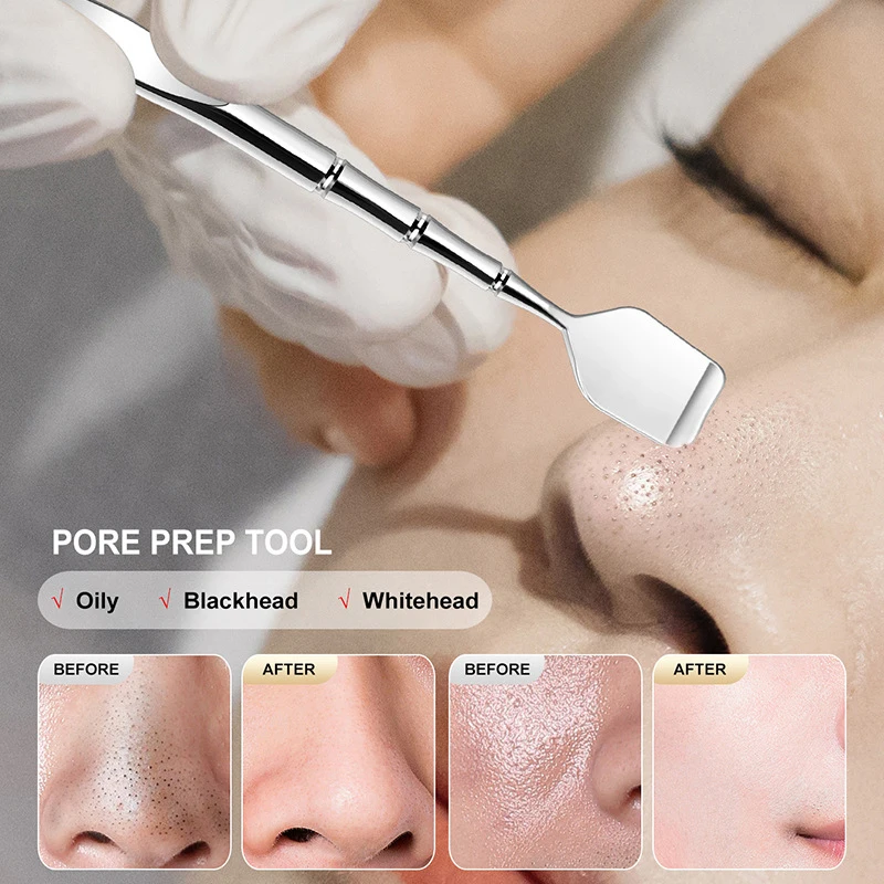 Двусторонний шпатель для удаления угрей нос лицо пятна очиститель пор зажим