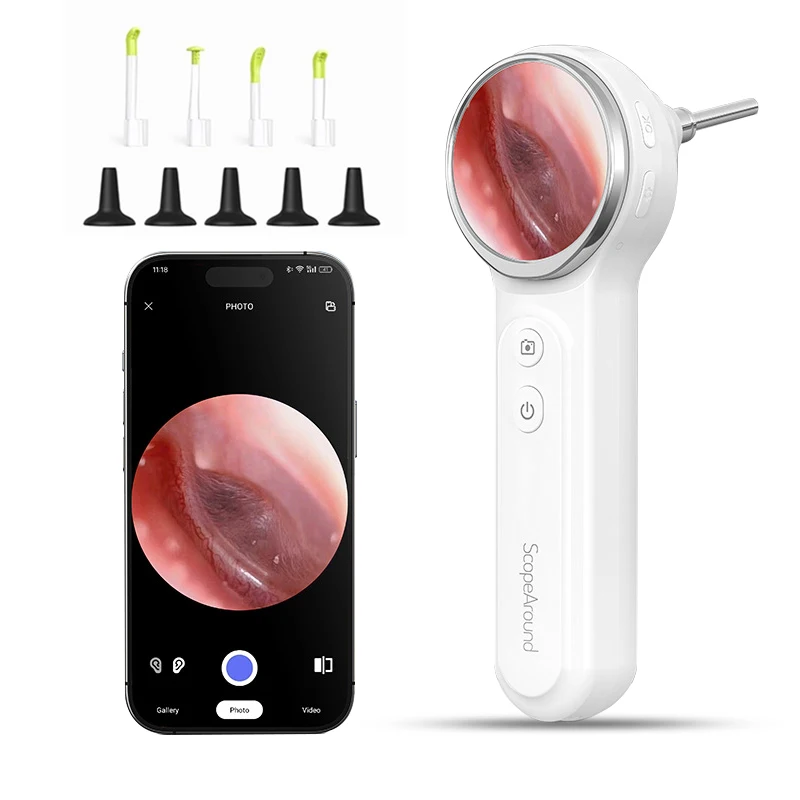 

CENBOL Цифровой отоскоп 3,9 мм