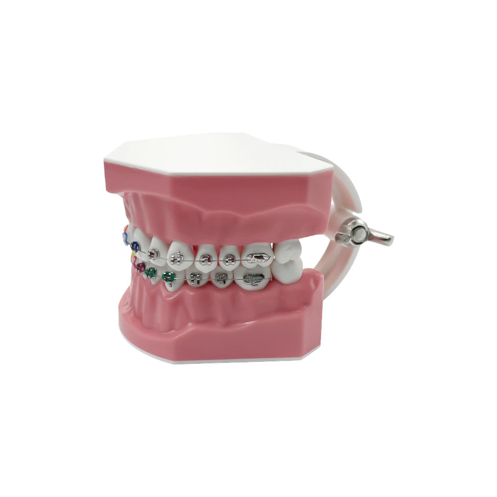 Полуметаллическая полукерамическая Стоматологическая Ортодонтическая модель
