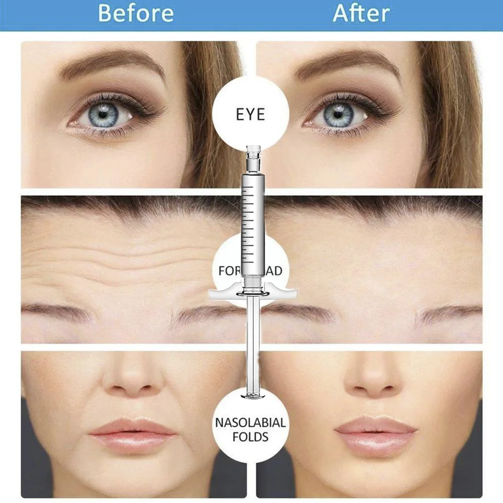 

Beauty Tools 2ml Hyaluronic Acid Filler wrinkle Hyaluronic Acid Filler Injections Enhancement Pen HA Lips Hyaluron Pen