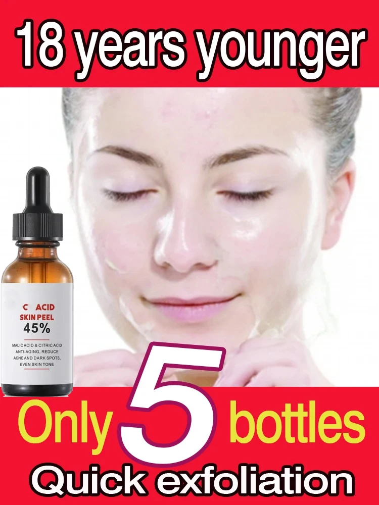 

Yellow Peeling Oil Bleaching Dark Skin Spots Remove Dead Skin Lighten Melanin Scrub Exfoliating Whiten Moisturize Face Skin Care