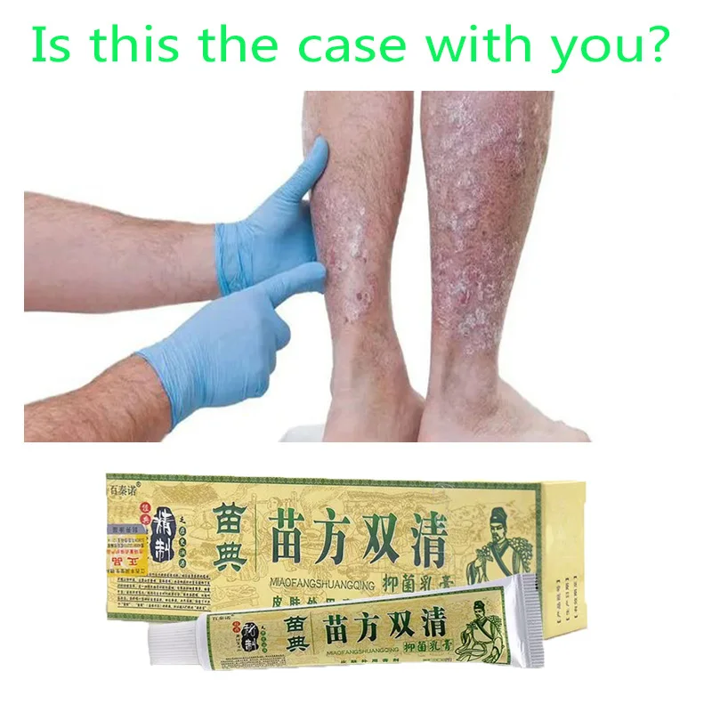 

Against Psoriasis Eczma Cream Natural Herbal Ointment Antibacterial Gel Anti-Itch Eczematoid Urticaria Body Skin Treatment 15g