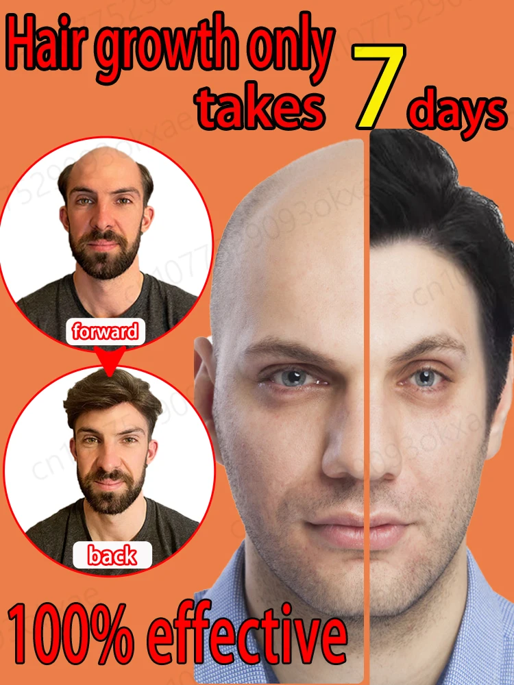

Hair growth oil seven days rapid hair growth effective bald repair hereditary hair loss postpartum hair loss seborrheic alopecia