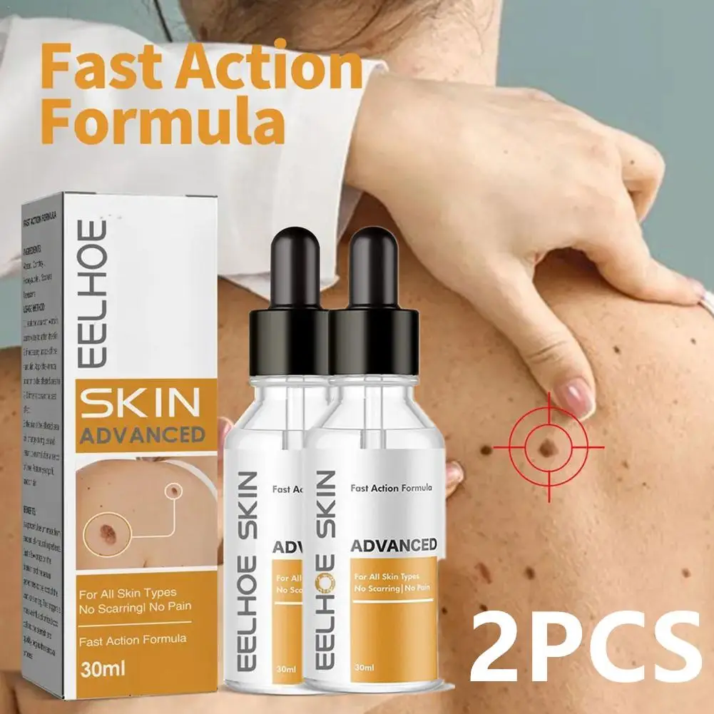 

2pcs Fast Action Serum Liquid Remover Drops Skin Cleansing Meat Thorns Painless Wart Removal Hands And Feet Corns Flat Plantar