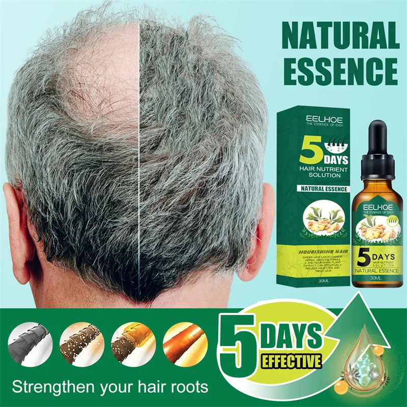 

5 Days Ginger Hair Growth Products Natural Anti Hair Loss Prevent Baldness Treatment Fast Growing Nourish Dry Damaged Hair Care