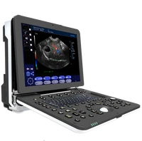 laptop portable animals ultrasound veterinary ultrasound machinevet handheld ultrasound scanner mindray ultrasound machine