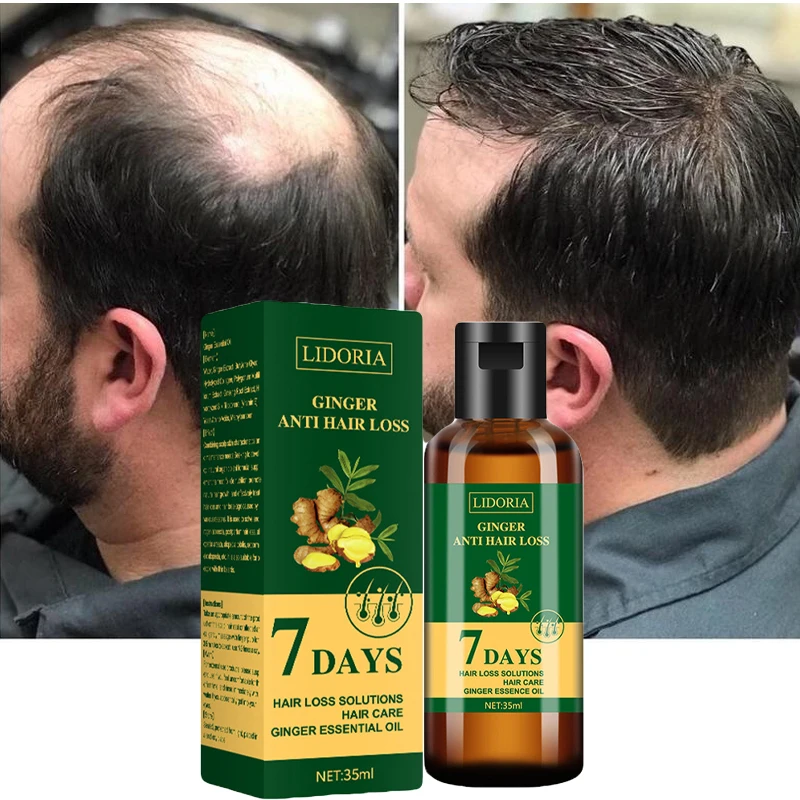Ginger Hair Growth Essential Oil Natural Anti Hair Loss Products Fast Grow Prevent Baldness Treatment Germinal Liquid Men Women