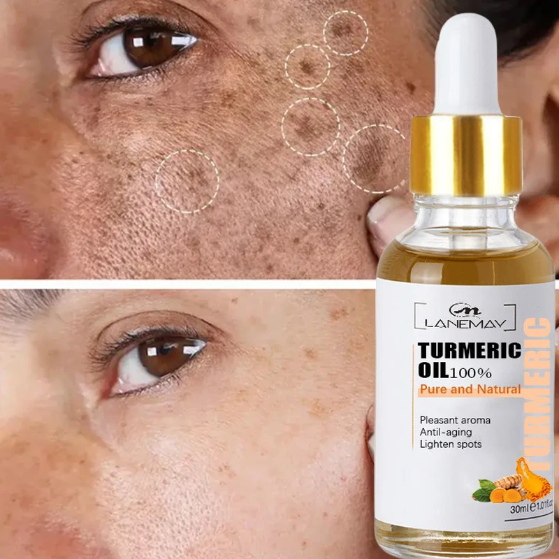 

Turmeric Freckle Whitening Serum Fade Dark Spots Removal Acne Pigment Melanin Correcting Turmeric oil Hydrating Face Skin Care