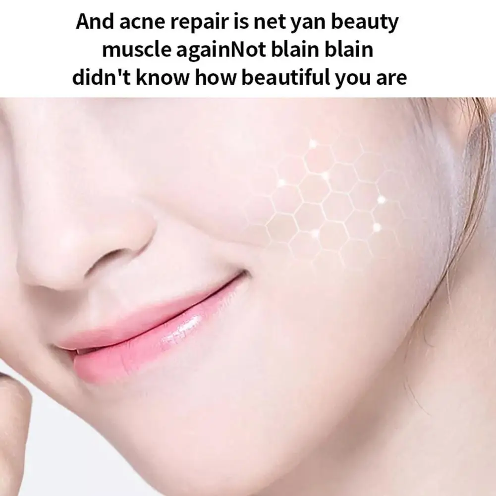 Крем для удаления акне с салициловой кислотой