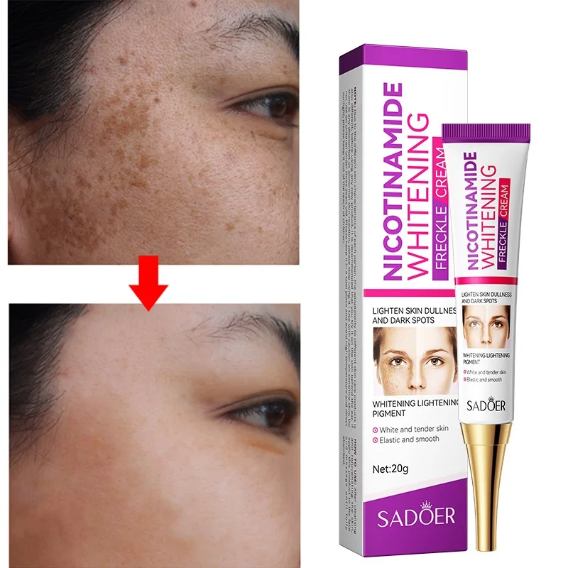 Niacinamide Whitening Freckle Cream Remove Melasma Acne Spot Pigment Melanin Dark Spots Moisturizing Brighten Cream Skin Care