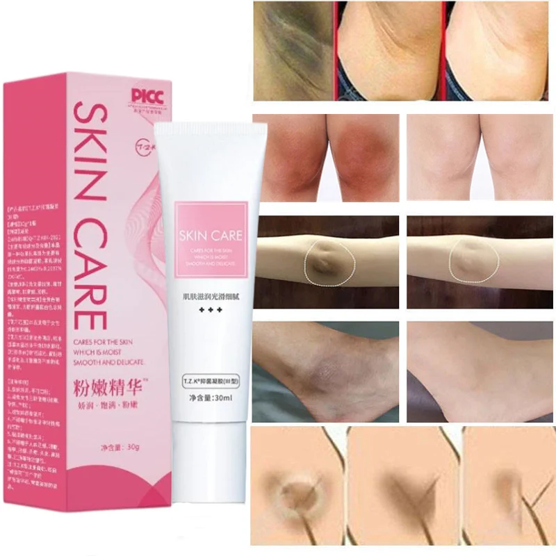 

Intimate Area Pink Firm Essence Body Whitening Cream Underarm Knee Butt Dullness Brighten Improve Lip Moisturizer Facial Care