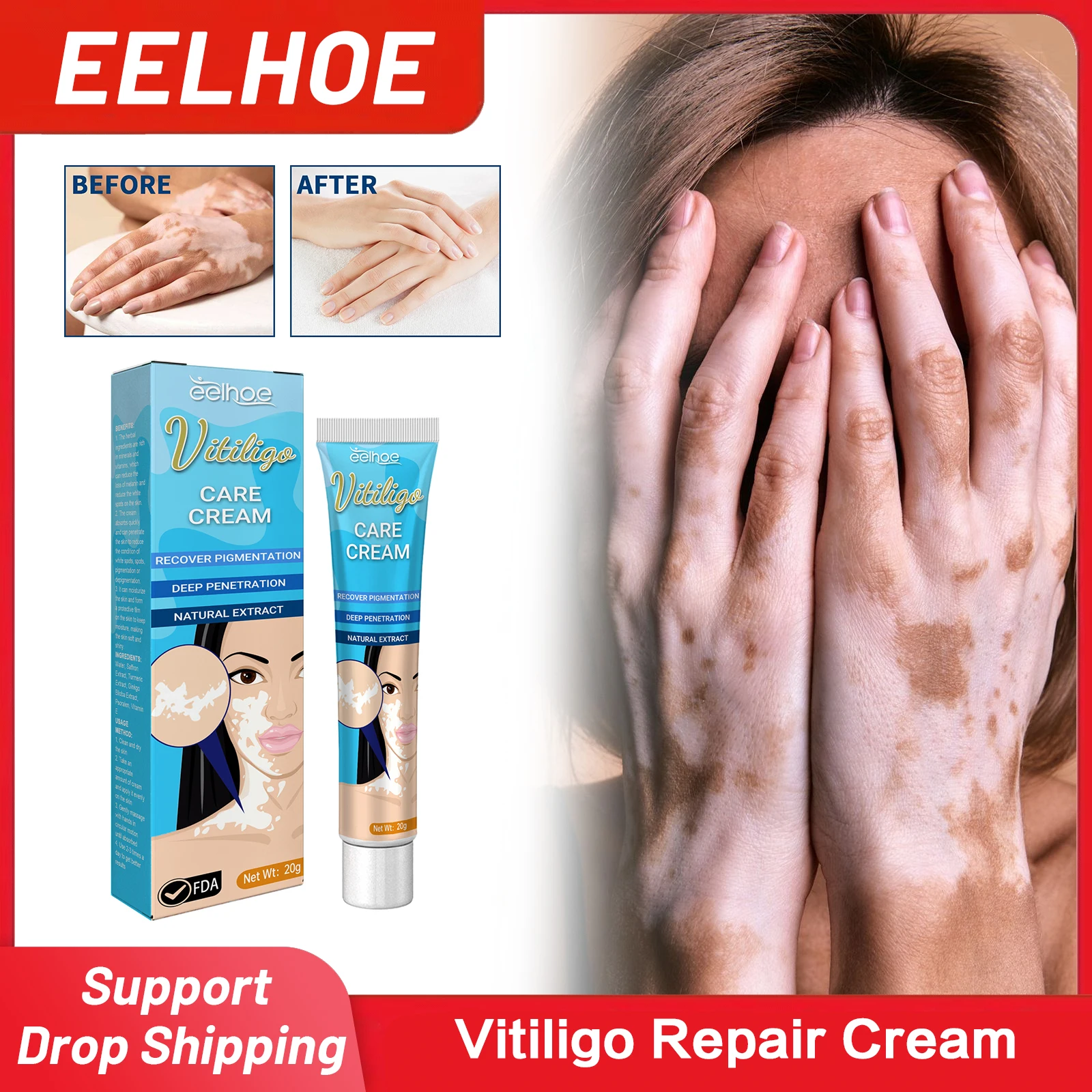 

Vitiligo Repair Cream Fast Remove Ringworm Leukoplakia Disease Treatment Reduce Pigment Melanin White Spot Removal Ointment 20g