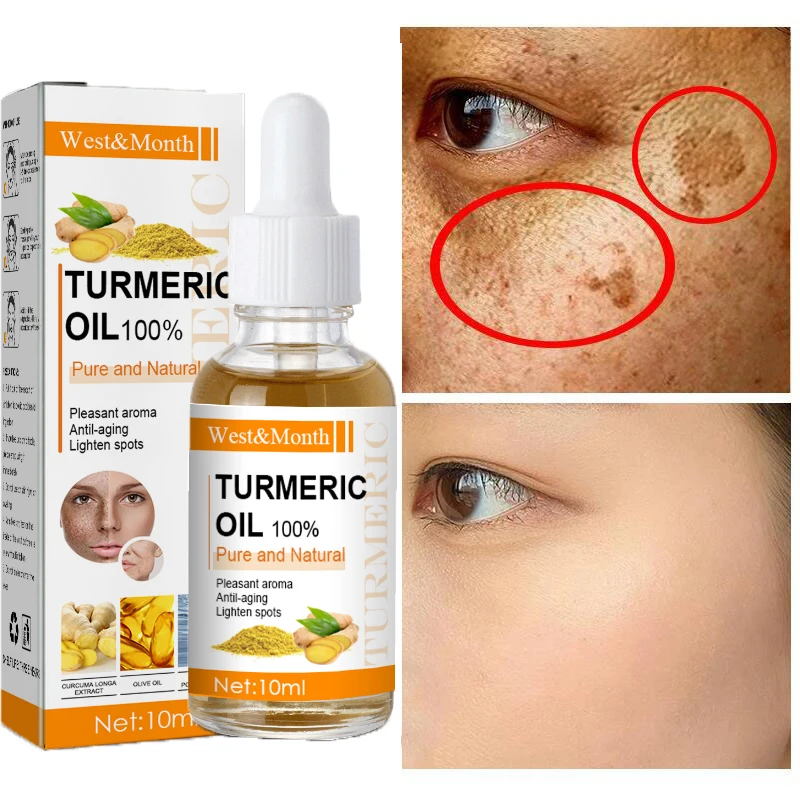 Turmeric Whitening Freckles Serum Remove Dark Spots Melasma Brighten Lighten Melanin Improve Dull Anti-aging Face Skin Care 10ml