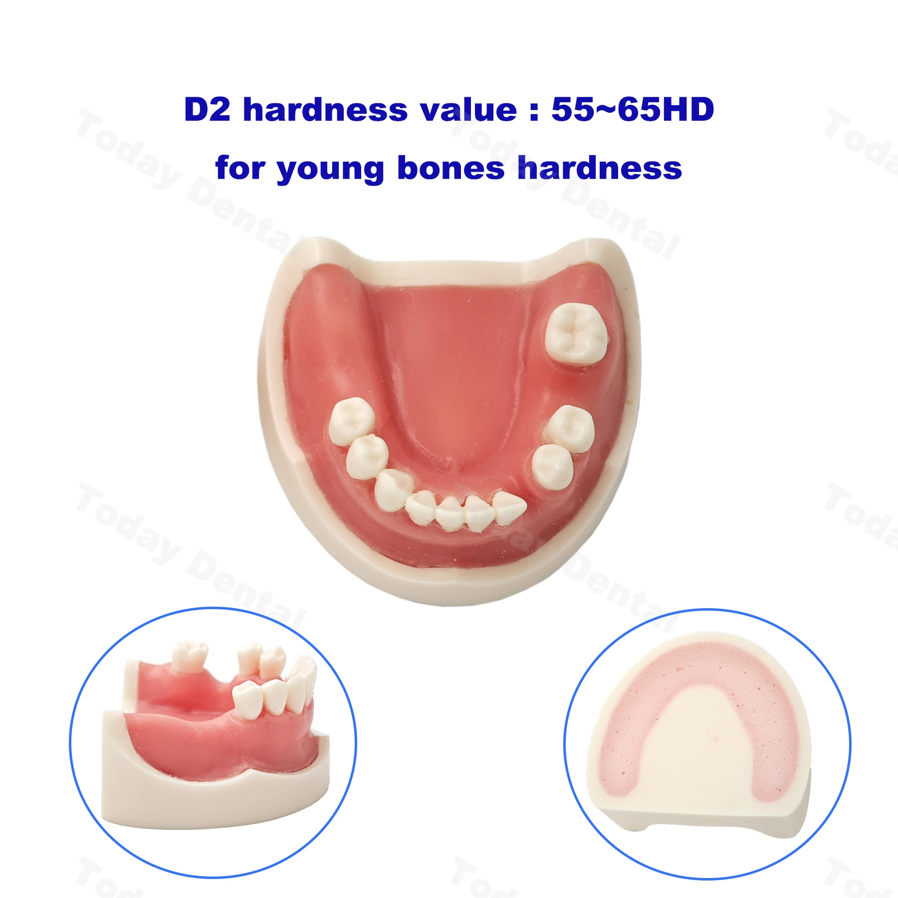 Зубной имплантат модель зубов тренировочная для дантиста Студенческая