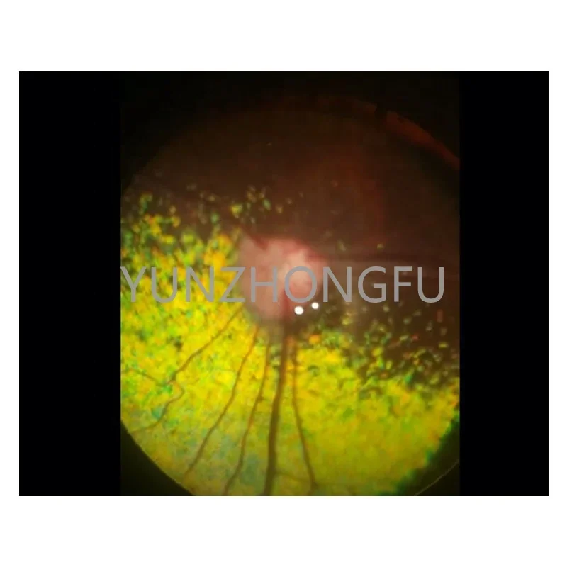 Рисунок 4 - Портативная немидрическая камера для офтальмологии