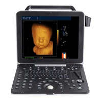 cy p6 new modern portable wireless ultrasound scanner color doppler portable ultrasound