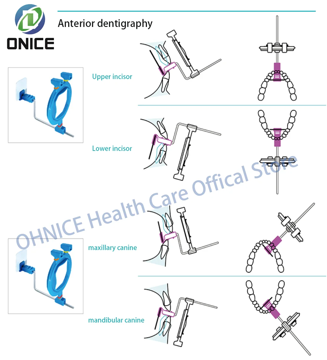 Стоматологический держатель для рентгеновской пленки стоматологический