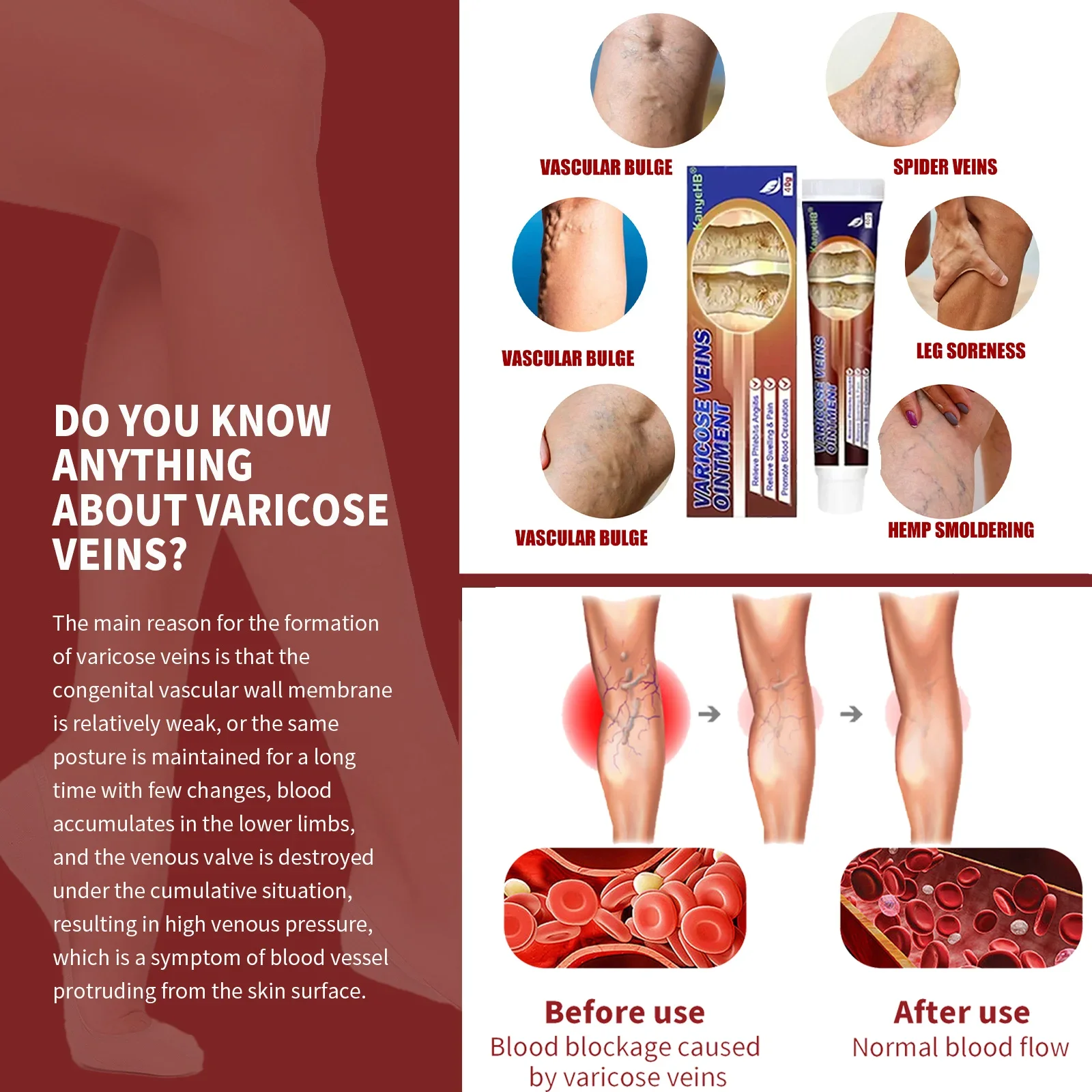 Мазь от варикозного расширения вен премиум-класса
