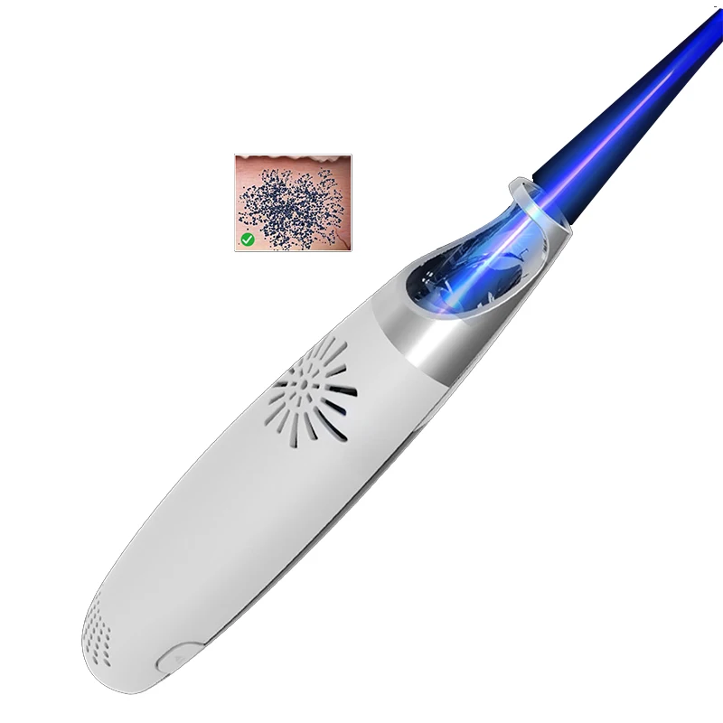 

Drop Shipping Professional Beauty Device laser picosecond laser pico sure tattoo machine pigmentation removal laser