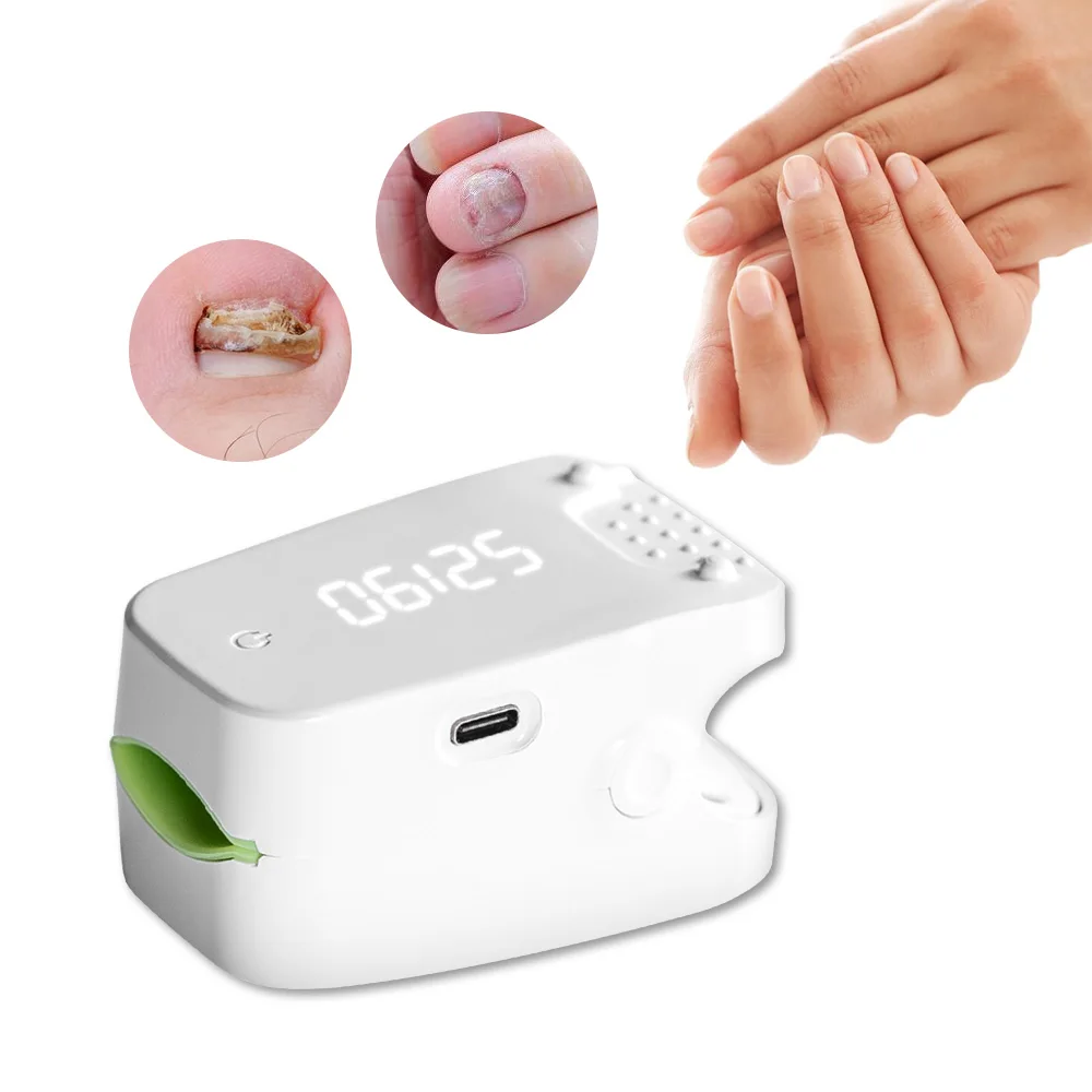 

Устройство для лазерной терапии ногтей, с USB-зарядкой, нм