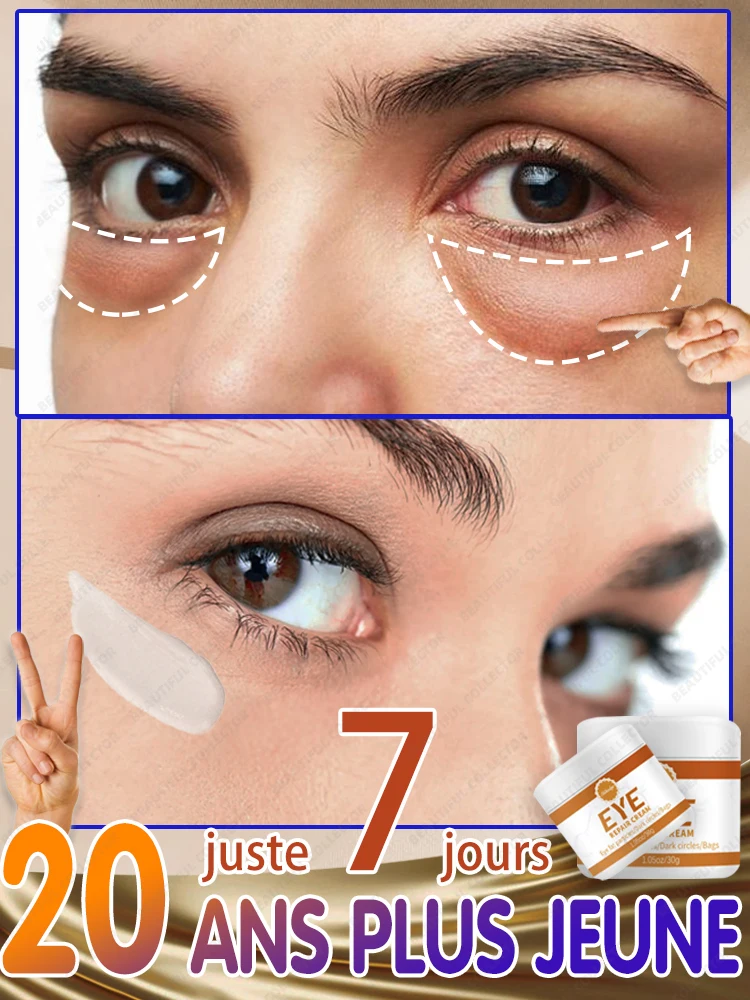 Крем для удаления темных кругов под глазами и морщин