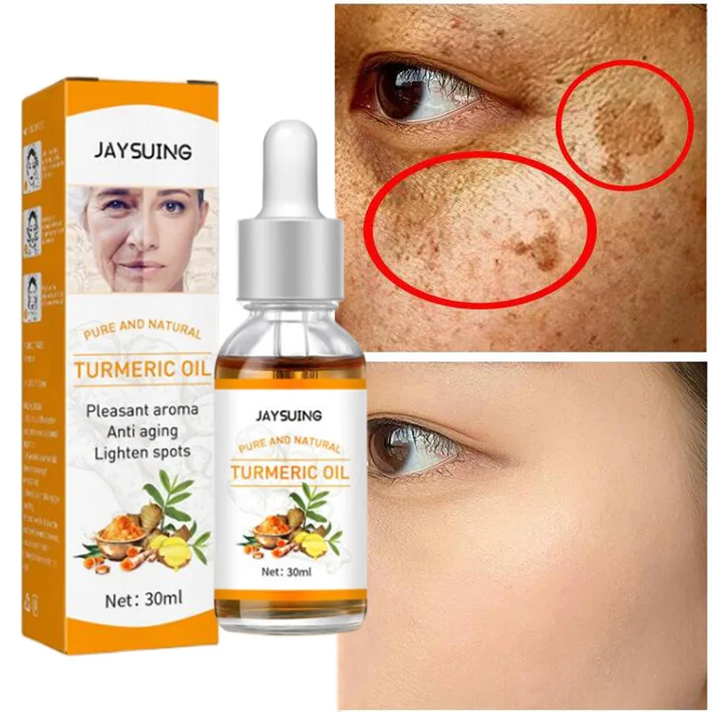 

Turmeric Freckle Whitening Serum Curcumin Oil Brighten Fade Dark Spot Removal Pigment Melanin Correcting Beauty Face Skin Care