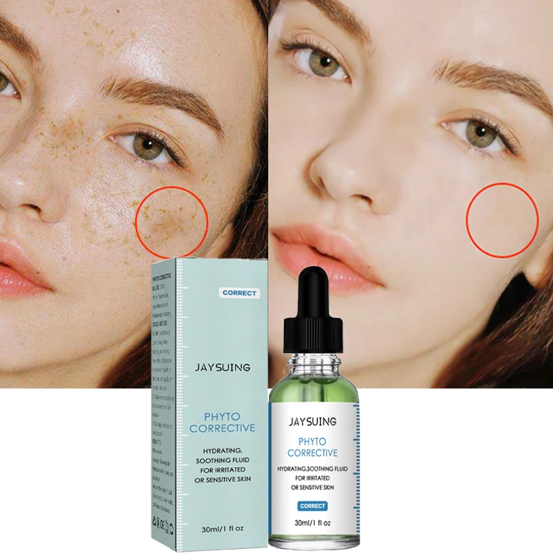 

Freckle Whitening Serum Remove Melasma Fade Dark Spots Essence Anti-wrinkle Improve Dull Brighten Moisturizing Beauty Skin Care