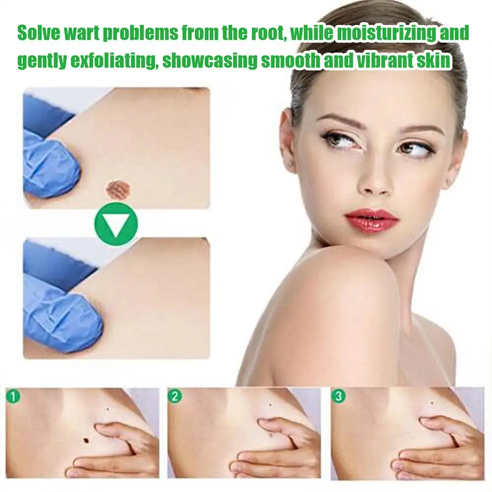 Рисунок 5 - Средство для устранения веснушек и бородавок