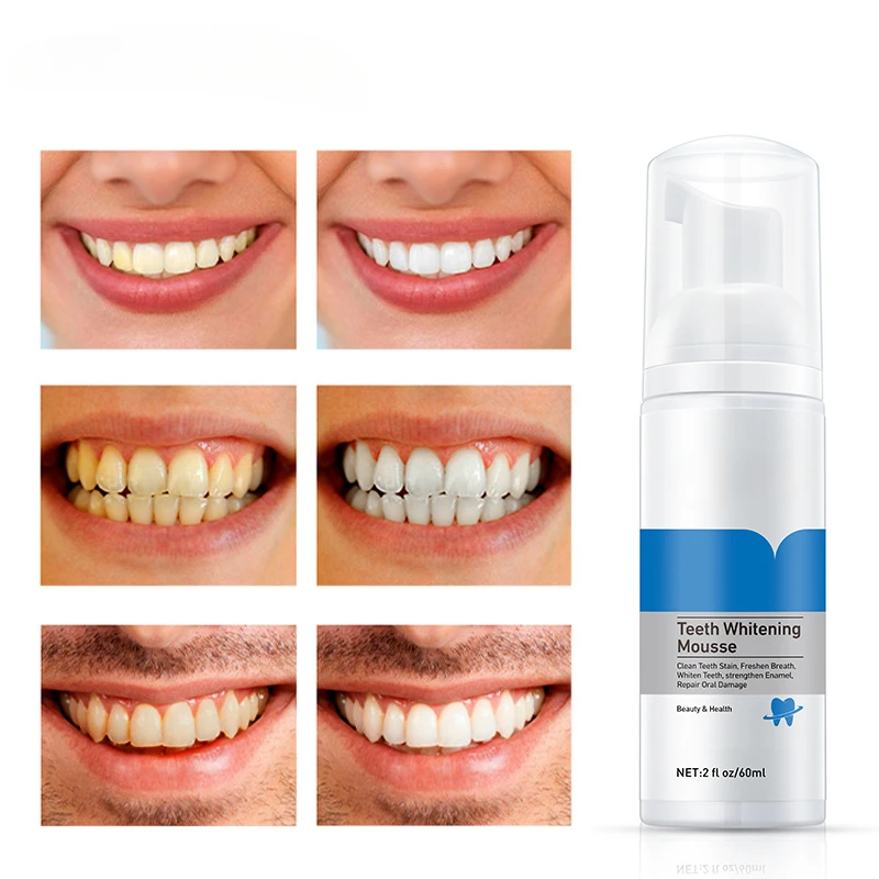 Зубная паста для отбеливания зубов 60 мл