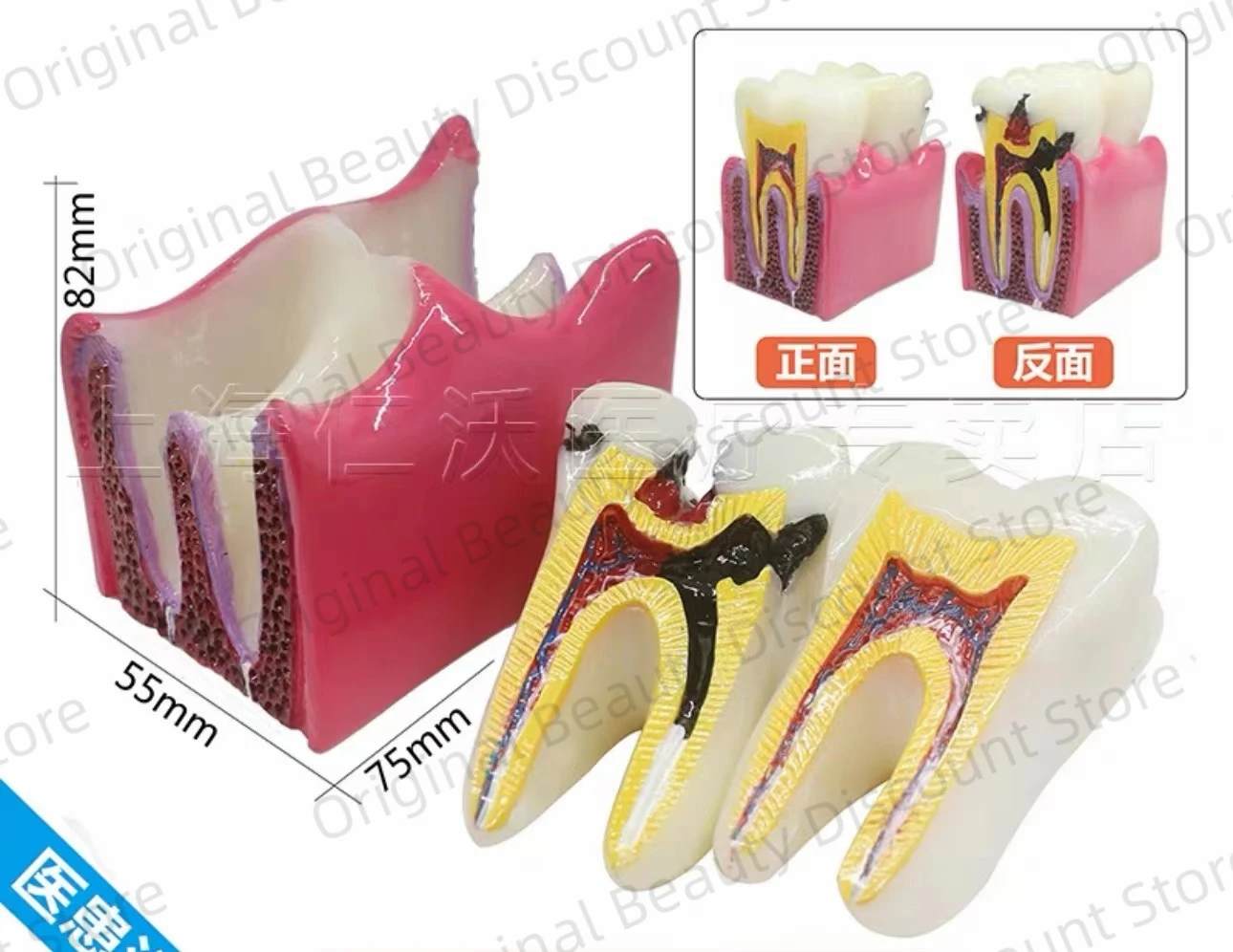 

Dental Implant Demonstration Model Teeth Study Teach Disease Analysis Decayed tooth Maxillary Mandibular detachable
