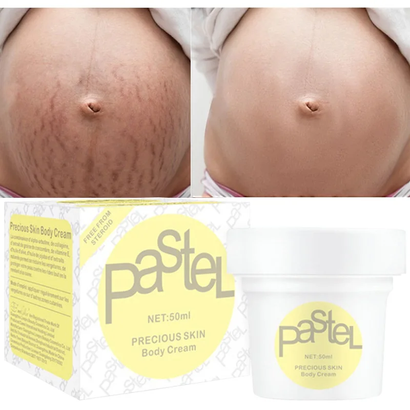 

50ml Stretch Marks Remover Cream Removes Postpartum Pregnant Women Scar Repair Obesity Mark Anti-Aging Firming Cream Maternity