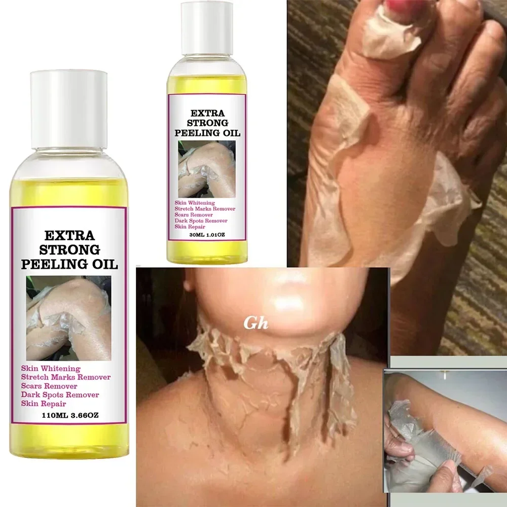 Экстра сильный желтый пилинг масло отбеливание осветление локтей коленей рук