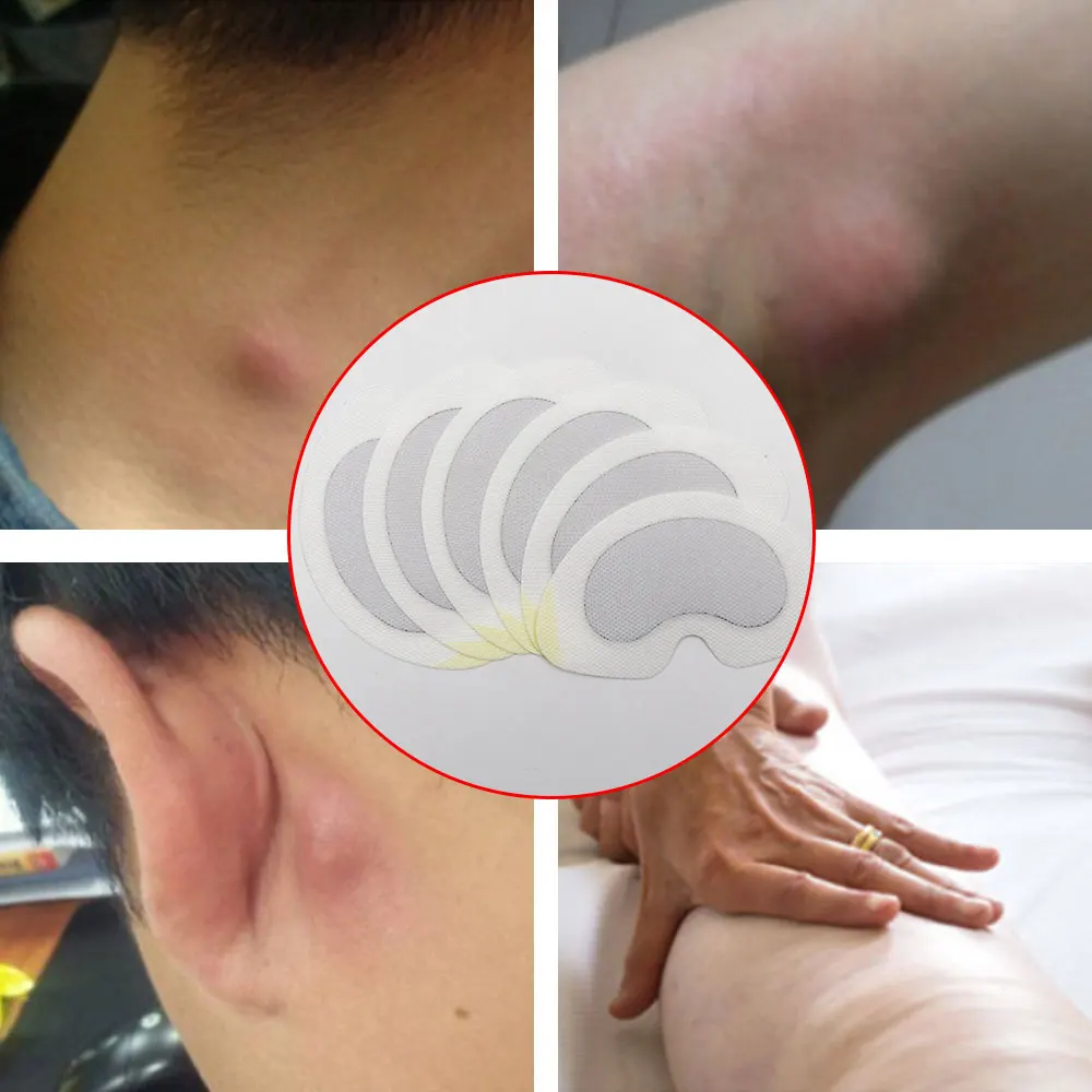 6 шт. органический лимфатический дренажный детокс-пластырь пластырь против