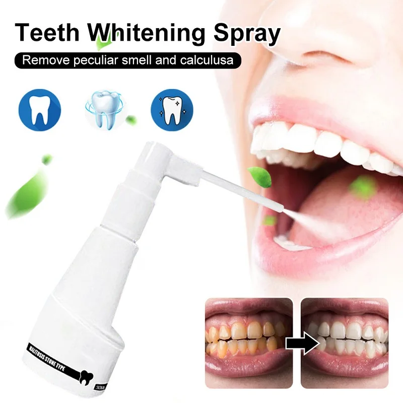 Teeth Whitening Spray Remove Teeth Stains Whiten Coffee Smoke Tartar Yellow Tooth Serum Dental Calculus Cleaning Liquid Care 30g