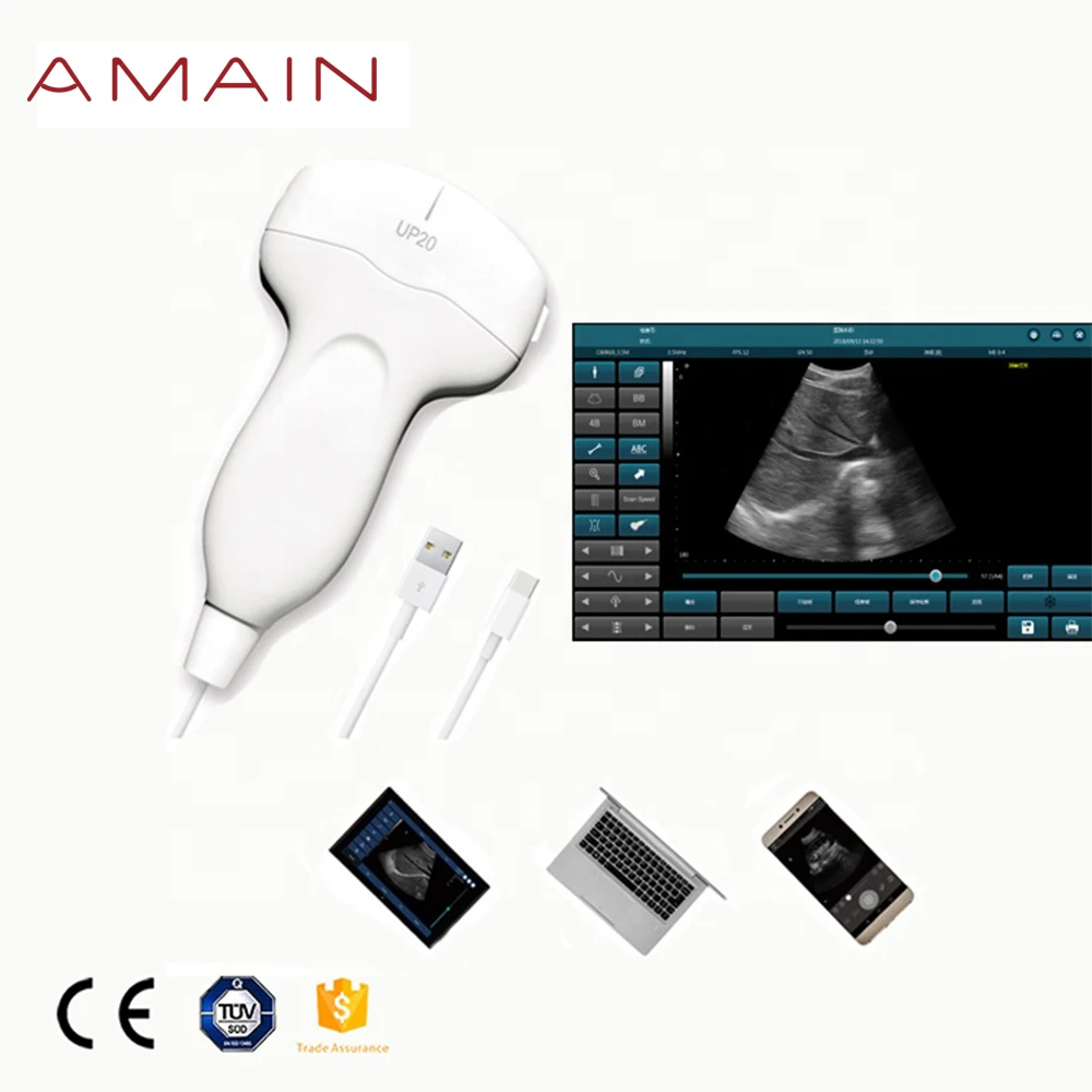 

Amain MagiQ 2 Convex basic Handheld Medical Portable Ultrasound Machine