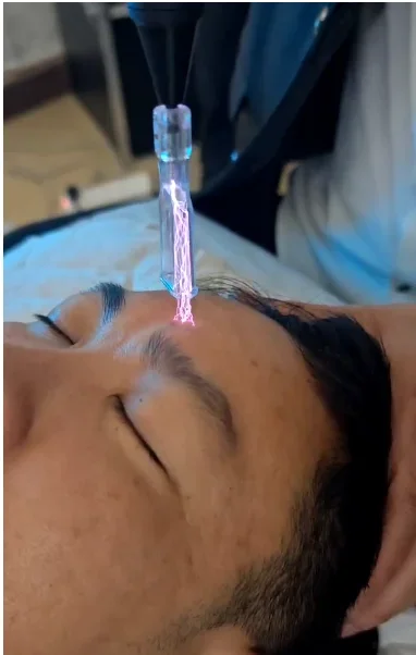 Популярная профессиональная плазменная машина Fusion 2025 года эффективно удаляет