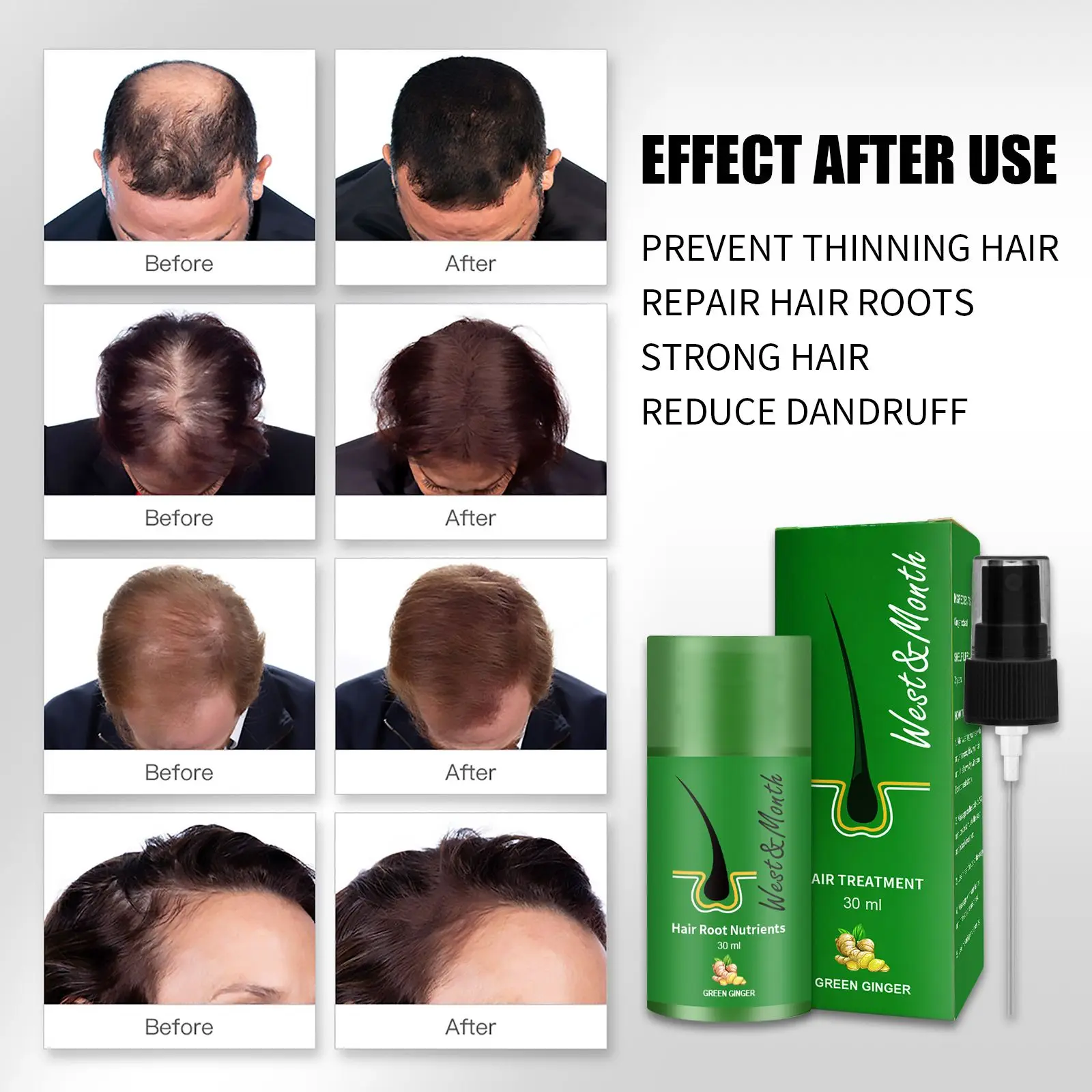 

30ML Germinal Baldness Repair Hair Loss Hair Regrowth Spray Haircare Treatment Serum Hair Root Nutrients