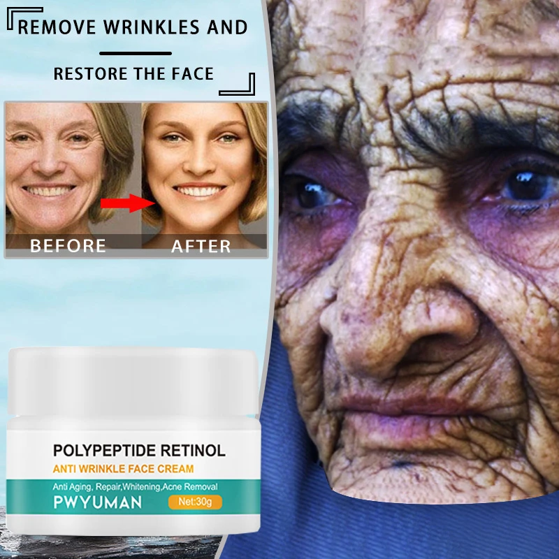 Рисунок 6 - Средство для удаления морщин и ретинола