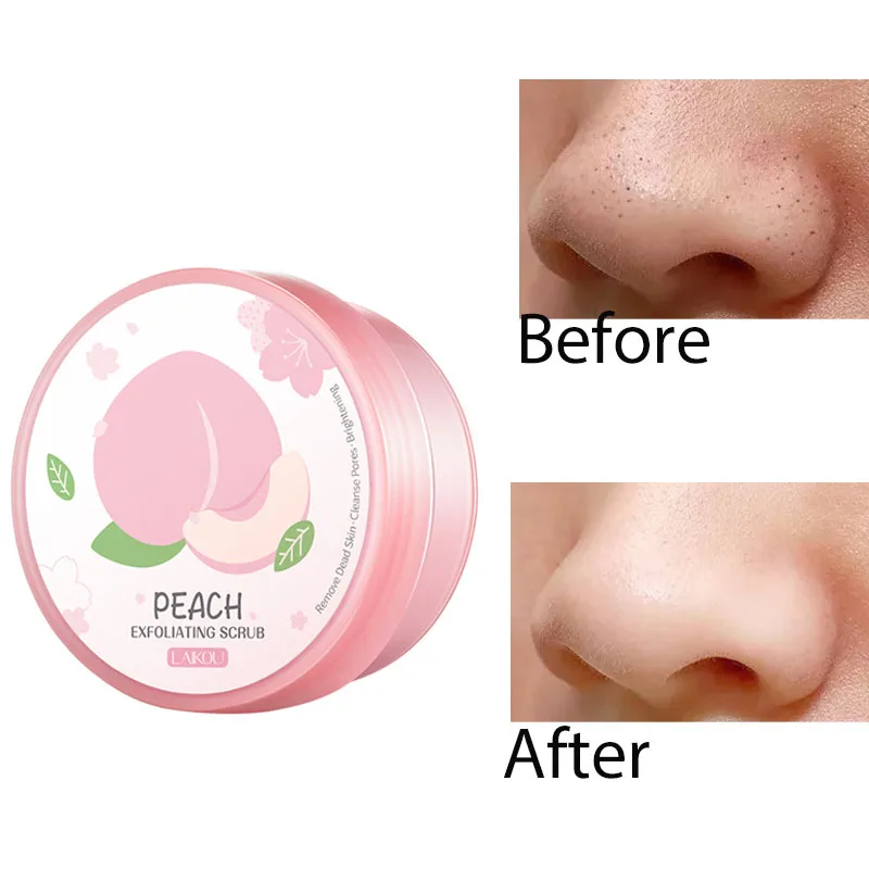 

Peach Esfoliante De Rosto Corporal Whitening Cream Pulizia Viso Face Scrub Corpo Acne Exfoliant Visage Feminino Free Shipping