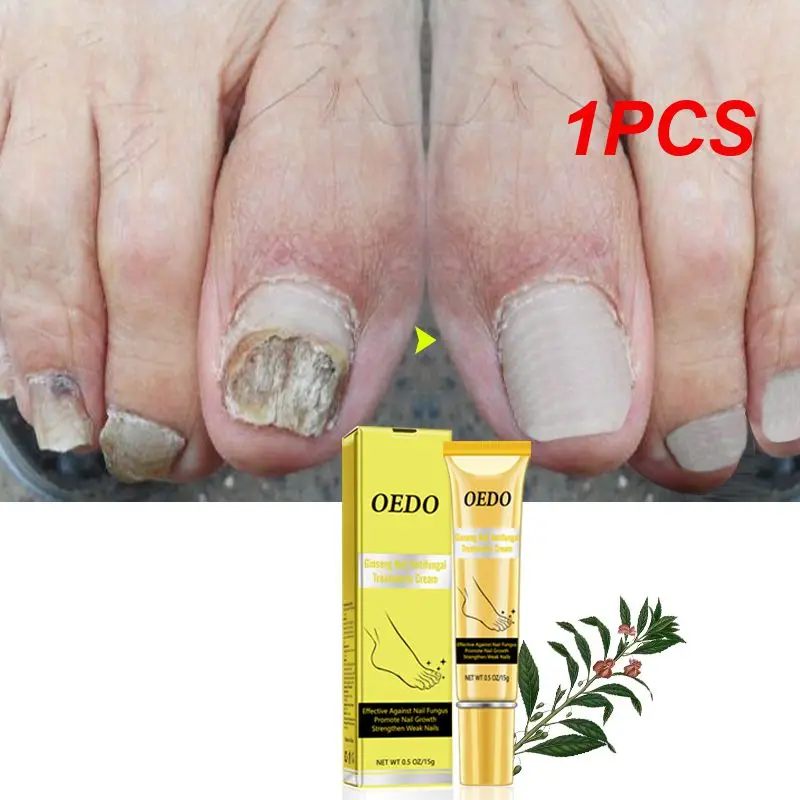 

1PCS Nail Repair Treatments Cream Anti Remove Nail Onychomycosis Paronychia Promote Nail Growth Foot Cream Brighten Nail TSLM2