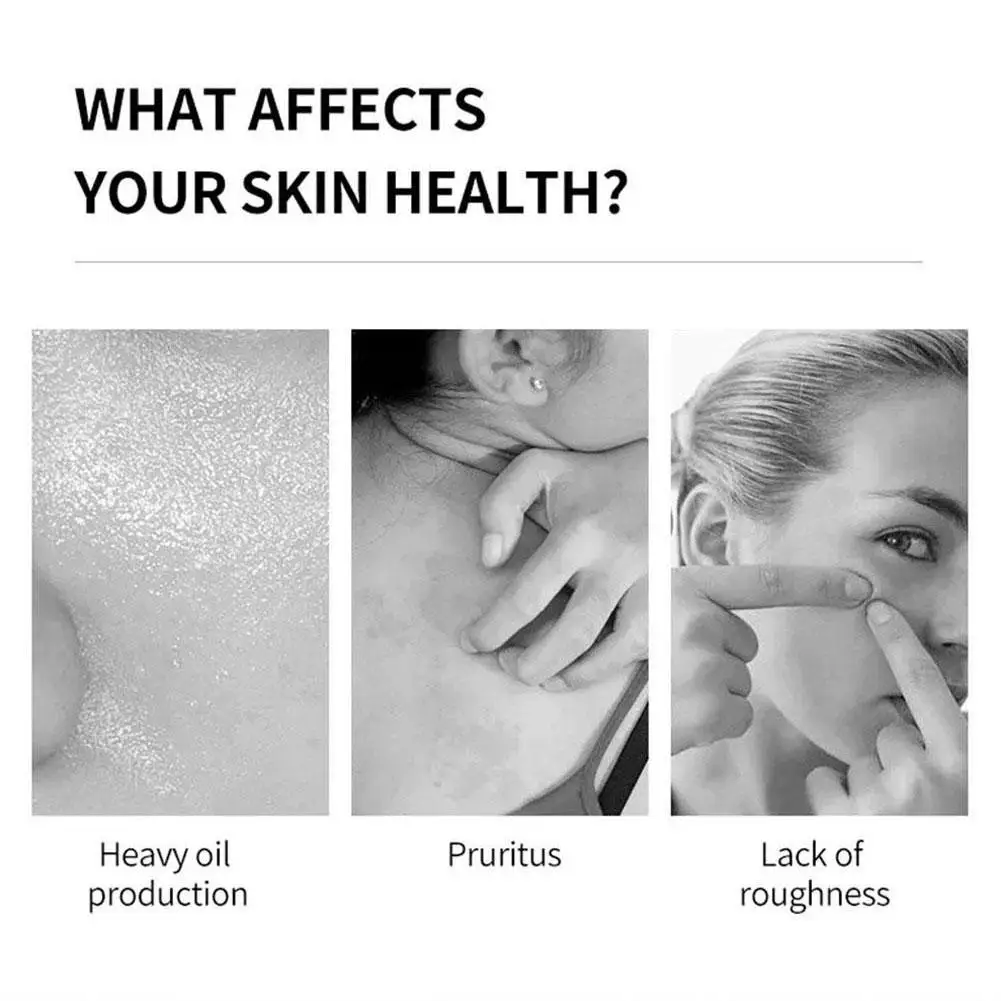 Рисунок 5 - Отбеливающее мыло для тела