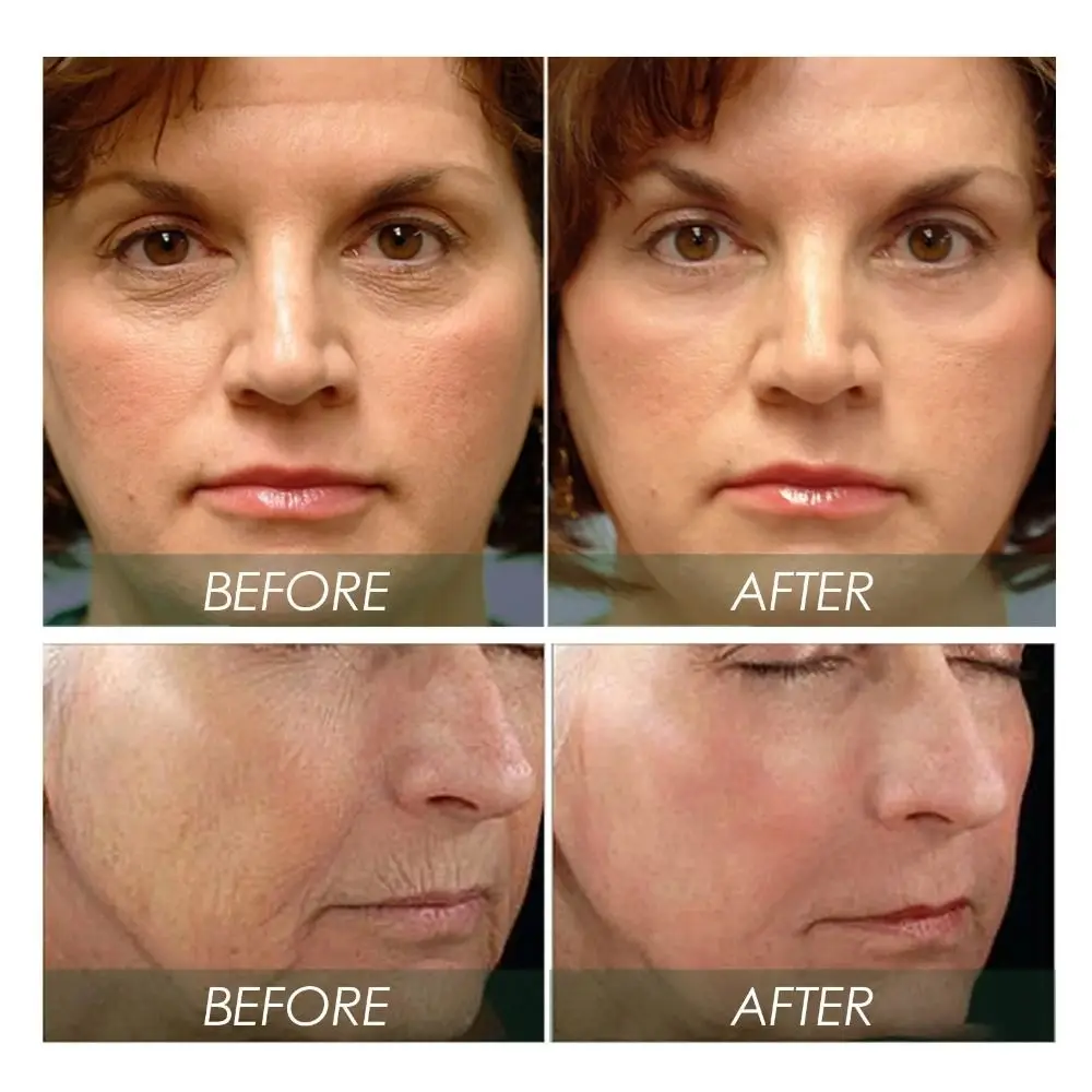 Коллагеновый крем для ухода за кожей лица 30 капсул