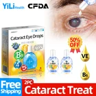 Лечение катаракты, медицинские капли для глаз, применяются для облачного глазного яблока, размытое зрение, перекрывание черных теней, одобренный Cfda витамин E,B6