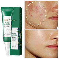 tea tree acne removal cream whitening moisturizing shrink pores oil control pimples acne scar treatment face gel skin care 20g
