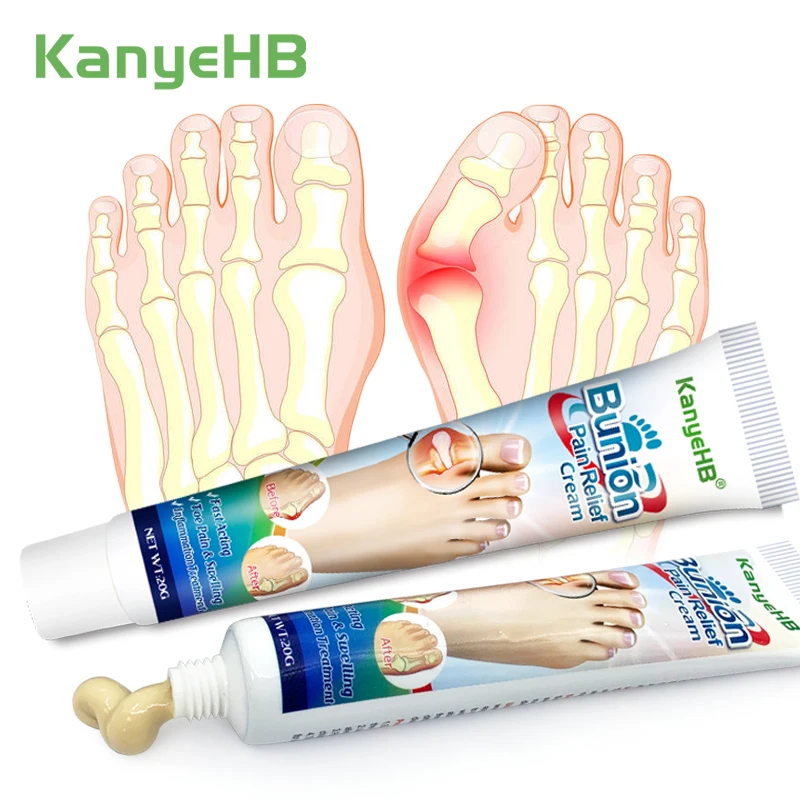 

2Pcs Tendon Sheath Ointment Hand Thumb Toe Pain Relief Cream Relief Stiffness Reduce Inflammation Treatment Bunion Cream A989