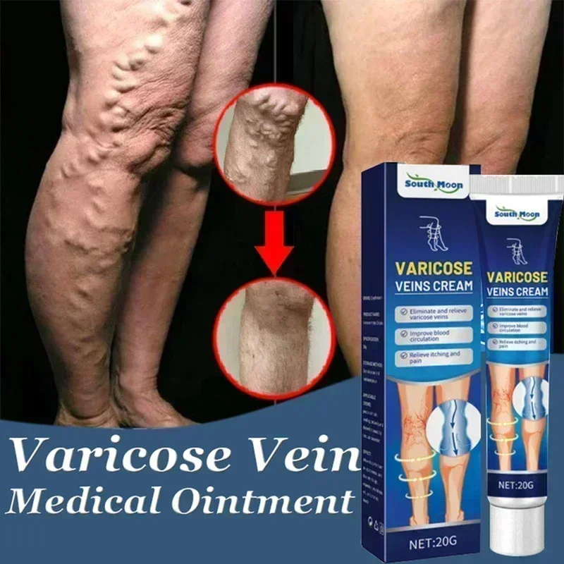 Мазь для мужчин от варикозного расширения вен Мошонка мазь Мужская снятия боли в