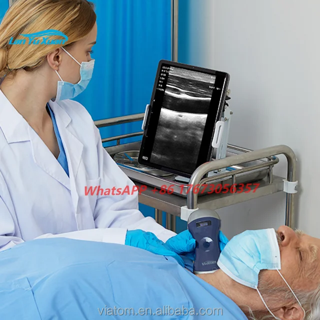 

Портативный ультразвуковой Viatom беспроводной ручной линейный допплер ультразвуковой зонд 128 элементов Беспроводной Сканер Ультразвуковой