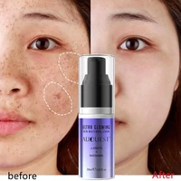 30ml auquest niacinamide whitening face serum arbutin fade dark spots brightening remove freckle speckle shrinks pores skin care